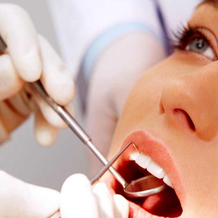 Tẩy trắng răng có có hại tới sức khỏe không?